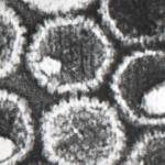 Herpes virus